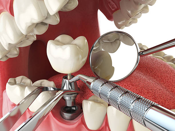 Best Weekend Emergency Dentist in Rensselaer, IN